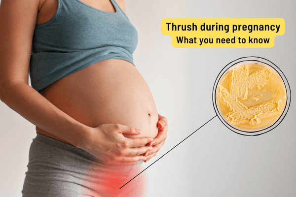 Thrush In Pregnancy
